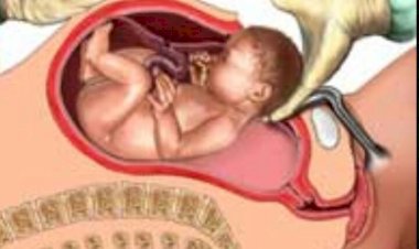 Jendela terbaik pilihanNya